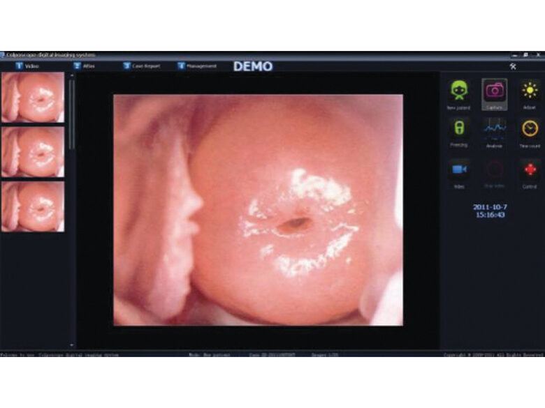 Uztveršanas karte un programmatūras komplekts LED video kolposkopam ar kameru AC-2311. Medicīnas ierīce Klase: I