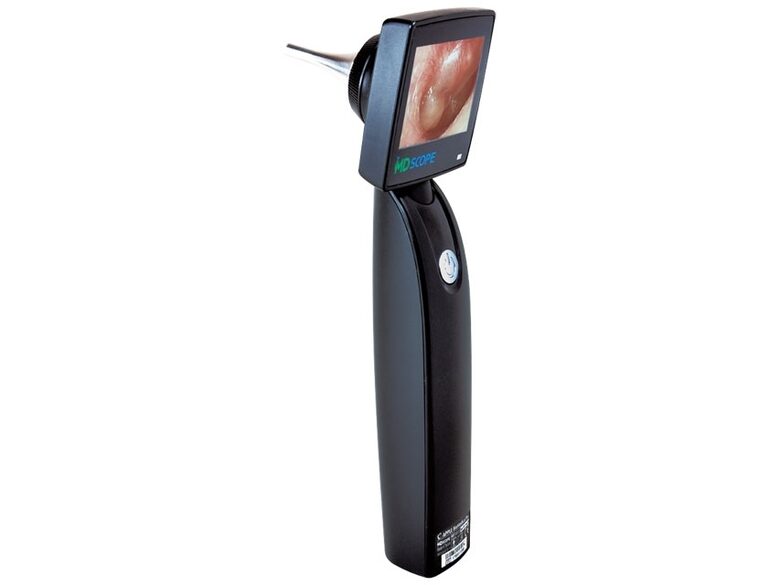 Video otoskops MD scope video otoscope DELUXE PACK MS102 ar 2 kameras zondēm 47 (Ø 4,2 mm)/150. Tips: Medicīnas ierīce Klase: I