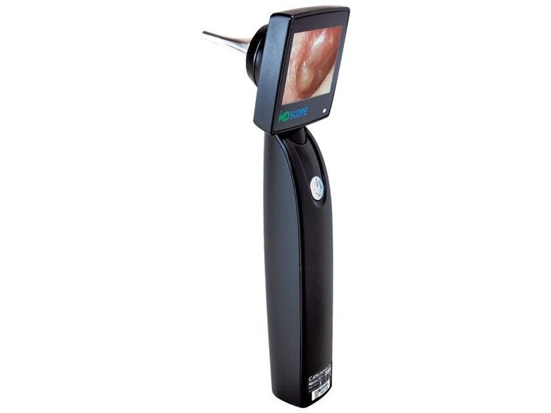 Video otoskops MD scope video otoscope DELUXE PACK MS102 ar 4 kameras zondēm 47 (Ø 4,2 mm)/75/150/300 mm. Tips: Medicīnas ierīce Klase: I